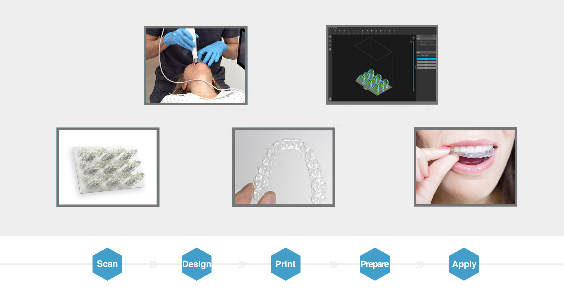 Dental 3D Printing  Solutions For Dentistry